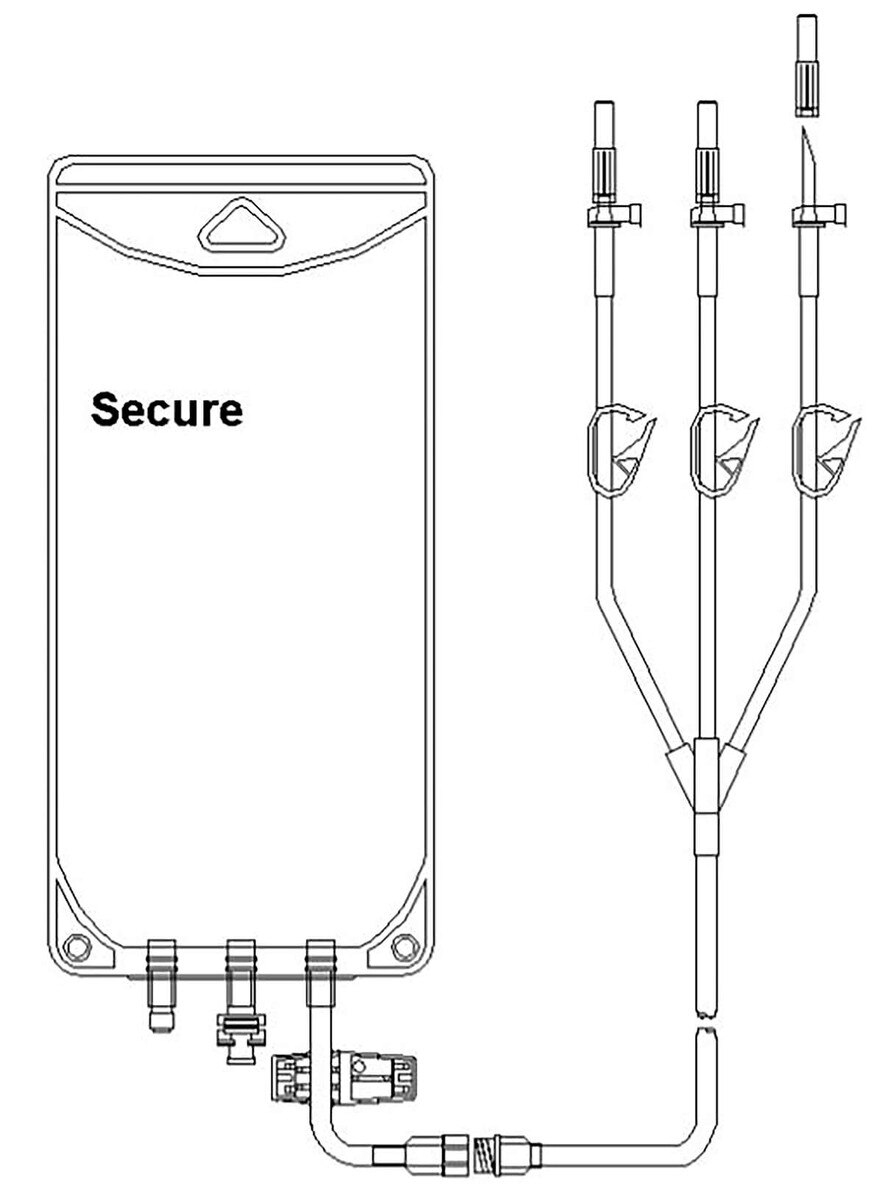 Technical diagram of the Metrix Secure 4,000 mL EVA gravity bag with three detachable fill legs and port configuration